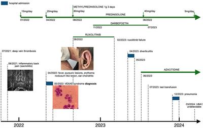 Case report: VEXAS syndrome: an atypical indolent presentation as sacroiliitis with molecular response to azacitidine